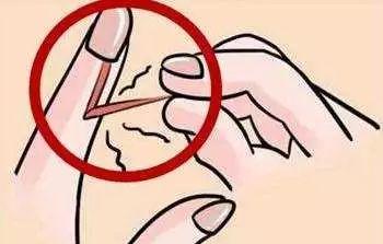 寶寶手指出現(xiàn)倒刺是怎么回事？需要補(bǔ)充維生素嗎？