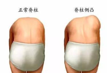 寶寶身高原來與脊椎發(fā)育有關(guān),有些動(dòng)作要注意！