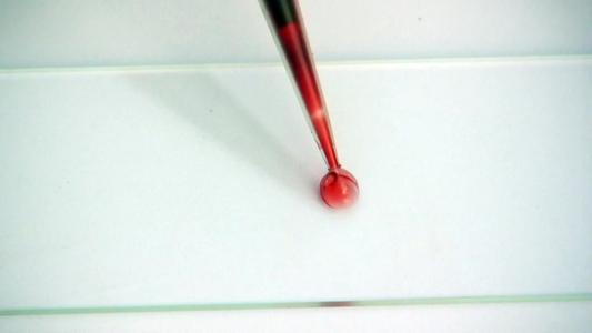 滴血可驗！鐘南山團隊研發(fā)快速便捷檢測試劑