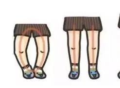 寶寶走路“八字腳”？或是因?yàn)榧议L做錯(cuò)了這些事！