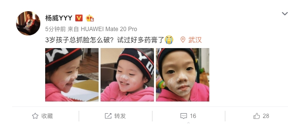 3歲女兒總愛抓破臉涂藥膏無果 楊威無奈發(fā)文求助