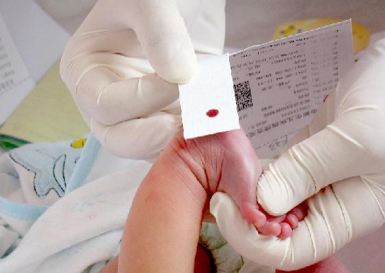 新生兒為何一定要化驗“足跟血”？關(guān)系到孩子的一生智力發(fā)育