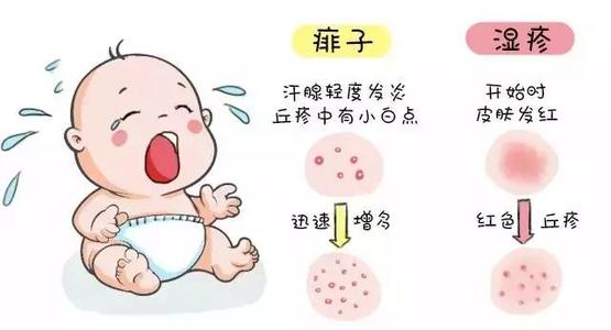 夏天來了：頑固的濕疹就是寶媽心里“打不死的小強(qiáng)”