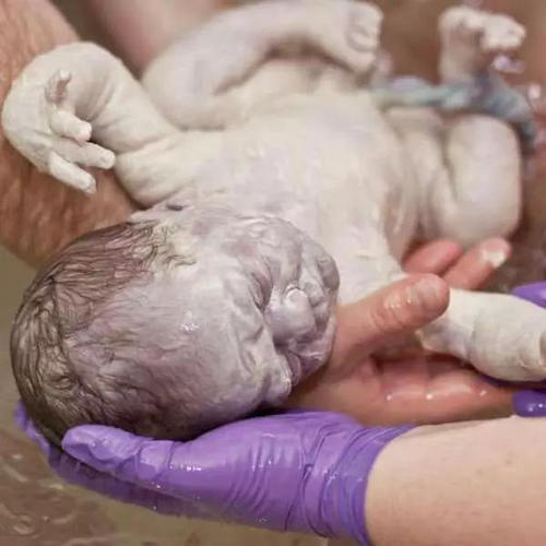 寶寶剛出生時(shí)身上一層白白的是什么？需要清理嗎？