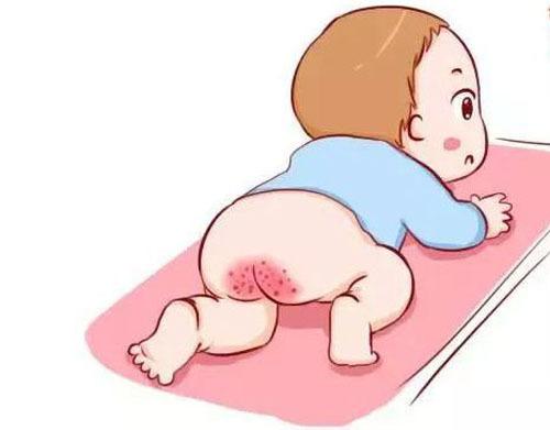 面對寶寶紅屁股，媽媽需要注意這幾件事