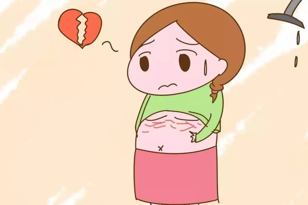 令人煩惱的妊娠紋，怎么才能預防呢？