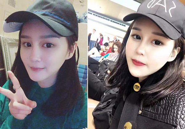 趙本山女兒撞臉李小璐？竟花30萬做鼻子！