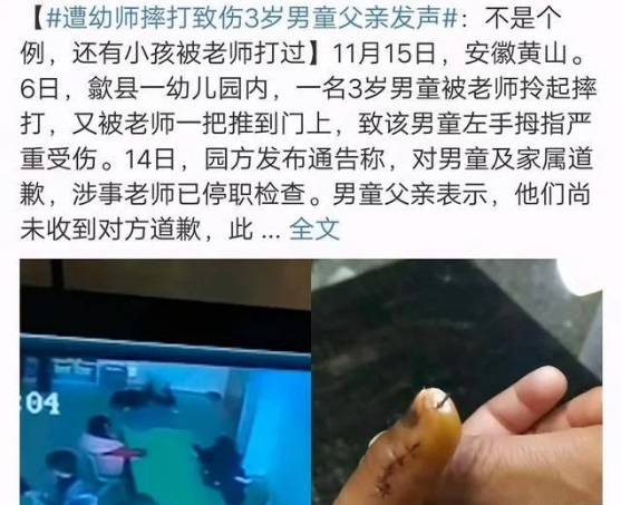 得知孩子被虐待，寶爸怒打幼師，園方袒護(hù)老師不道歉不讓報警