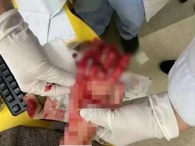 趁媽媽不注意，女孩將手伸進(jìn)了絞肉機(jī)，血的教訓(xùn)！