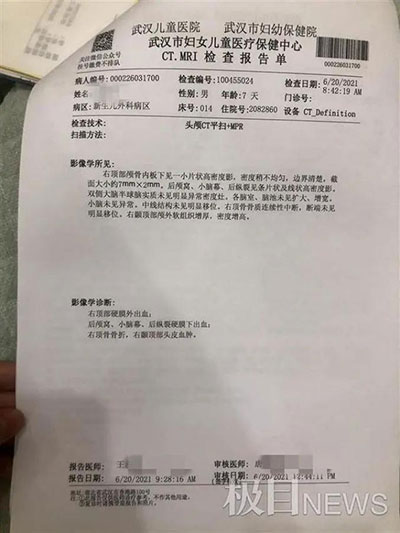 痛心！出生6天寶寶被月嫂摔成顱骨骨折