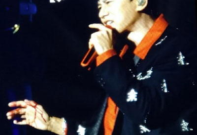 張杰舞臺(tái)事故受傷，去醫(yī)院前還在關(guān)心是否嚇到了孩子