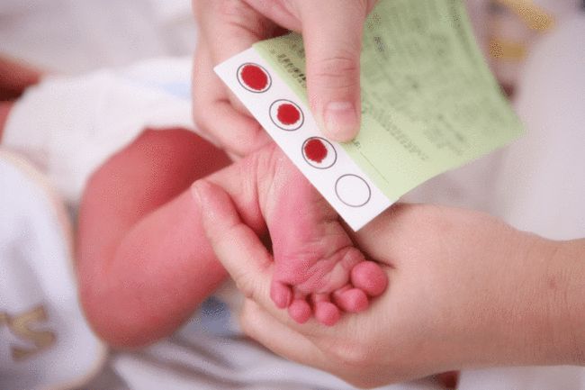 新生兒采足跟血，好處多多