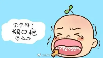 什么是新生兒鵝口瘡？