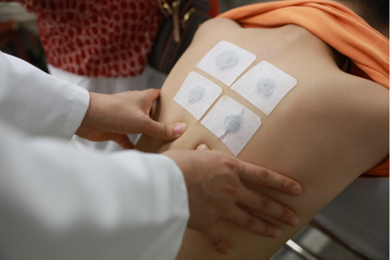 三伏貼開貼！高溫天對三伏貼效果增加助力